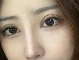 微密圈 - 谁需要普通？这是海豚baby眼镜的叛逆之作，图集和下载一把抓！